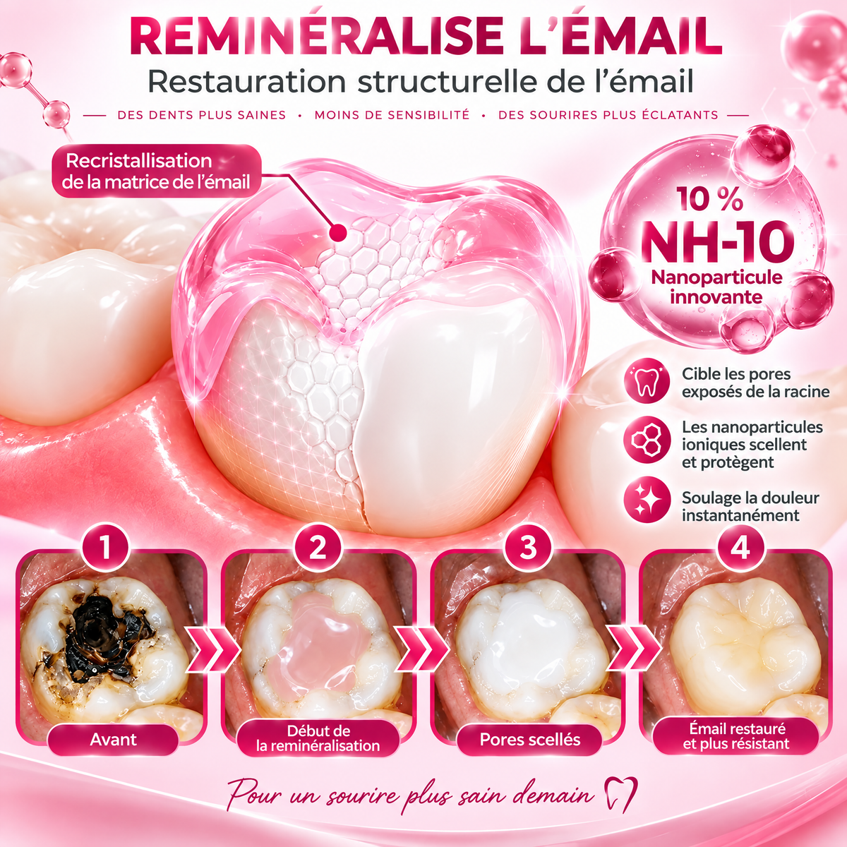 Cavity-Repair Natural Enamel Filling Gel